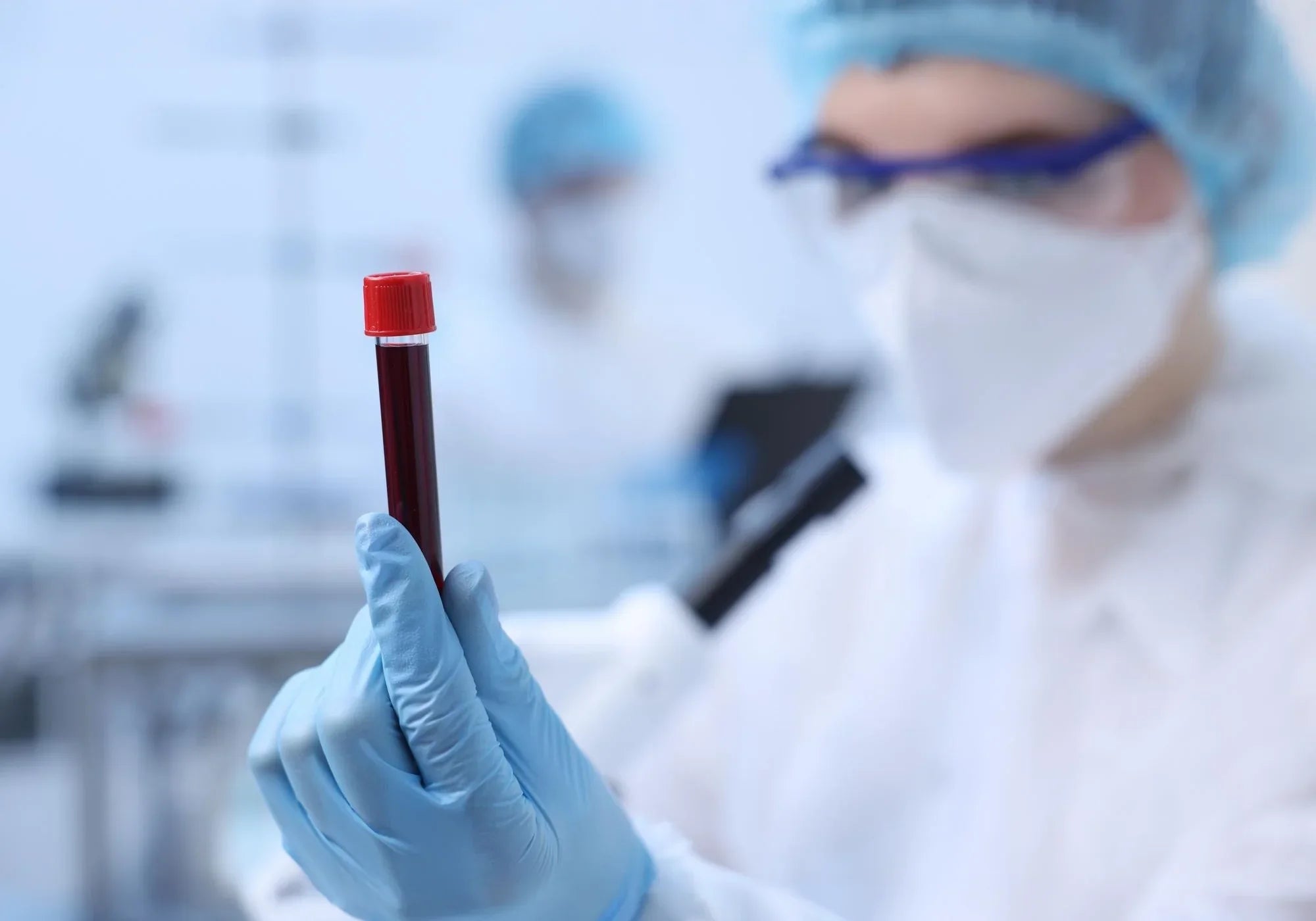 Всичко за анемията: същност, причини, симптоми, диагностика и лечение